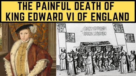 king edward's illness